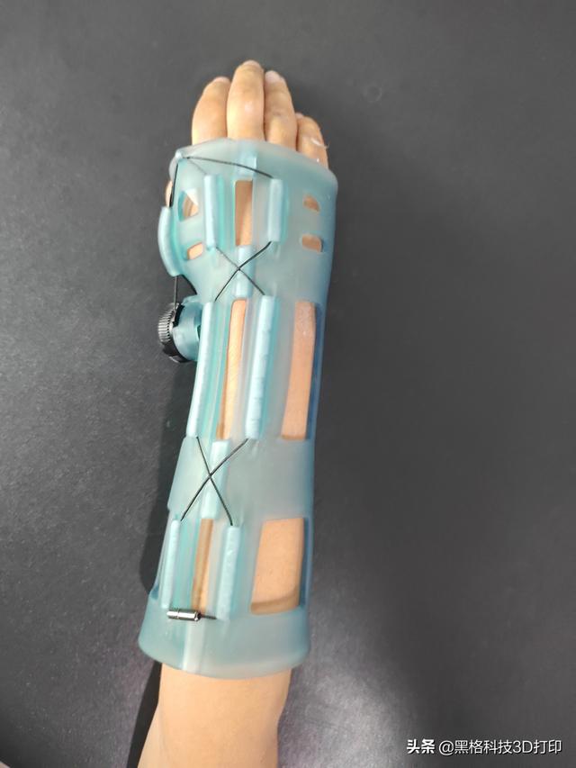 打了石膏痒怎么办