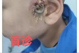 【技术】护理伤口，江西省儿童医院这个门诊很专业图片