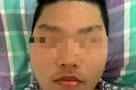 初三男生全身皮肤莫名溃烂，竟是因为吃了这种水果，目前正大量上市图片