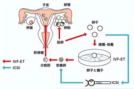 试管婴儿成功率？高龄？卵巢早衰人群试管前应该如何调理？图片