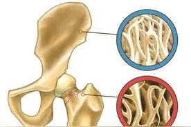 活络、止痛、壮骨，3种治疗骨关节炎、骨质疏松的中成药要知道图片
