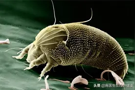 疥螨到底是什么？感染后有何症状？这几种传播途径，男女都要小心图片