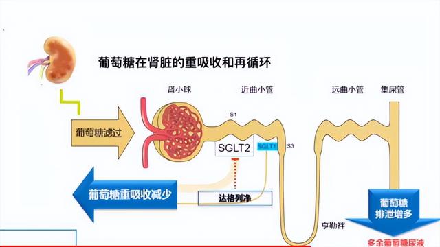 您了解尿糖“阳性”的原因吗？