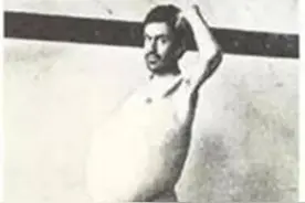 国外一男子因大便排不出来，29岁死在厕所，巨型结肠陈列在博物馆图片