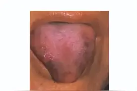 淤血体质？教你一剂活血补血药，活血不伤血，补血不留瘀图片