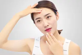 玛恩医生 | 积雪草成分可缓解痘印烦恼？图片