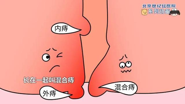 痔疮大便出血咋办（痔疮出血该如何处理）