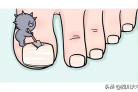 指甲灰就是灰指甲？华西专家说，鬼扯，起码有一半都不是！图片