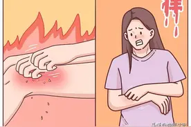 一个中成药，止痒有一套 化解皮肤病，远离湿疹 荨麻疹 皮炎 皮肤瘙痒图片