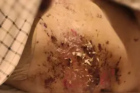 70岁阿婆半夜头撞墙！我爸妈请来大仙驱“鬼”图片