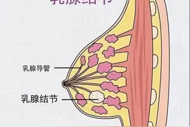 发现乳腺结节 应放任不管还是密切随诊？图片