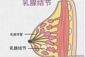 教你一招，两个中成药搭配，乳腺结节消失不见图片