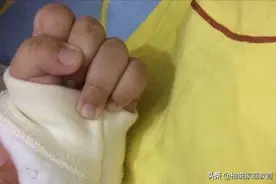 9个月婴儿紧握拳头，奶奶发现有问题带去医院检查，医生：来迟了图片
