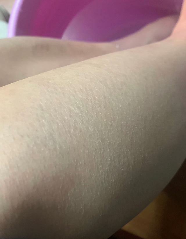 冬天身体乳需要全身涂么