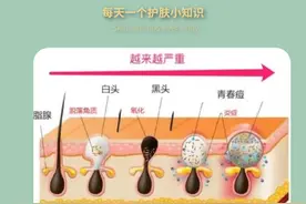 黑头千万不要这么挤图片