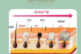 黑头千万不要这么挤图片
