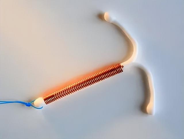 女性放节育环到底是好是坏,利弊如何,真必要吗?医生一文说清