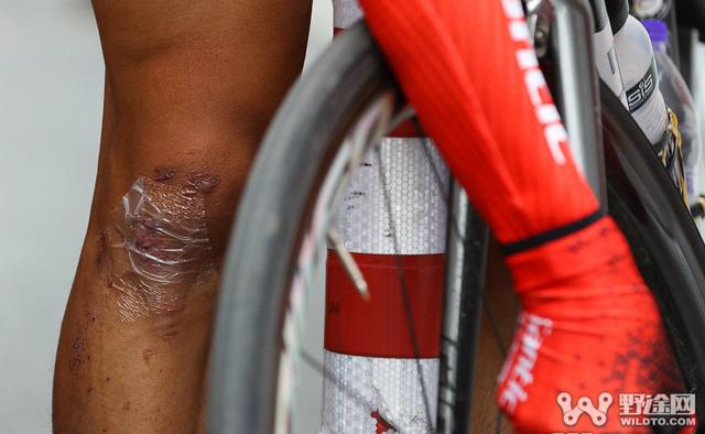 啥是支链氨基酸 对骑行有好处吗