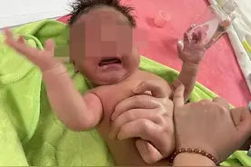 婴儿住进ICU，疑做“排气操”诱发？医院：排气操已暂停，全力救孩子；专家：具体病因需鉴定图片