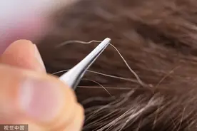 【科普多一点】白头发拔一根长三根？到底该不该拔？终于弄清楚了！图片