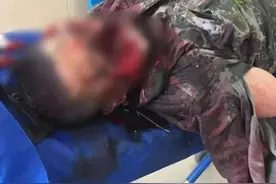 可怕！黑龙江一男子疑被黑熊咬掉半边脸，人遇到熊该怎么办？图片