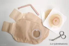 一个人没了肛门会怎样？我国“造口人”超百万，痛苦却无人能懂图片