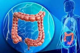 频繁放屁，是肠癌的警示吗？提醒：出现4种异常，早做筛查为妙图片