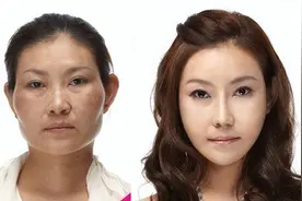 女神整容前究竟有多丑？朴敏英9年换头5次，刘仁娜整容痕迹明显图片
