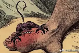 一个专治痛风的药，把骨缝的湿热逼出来，关节红、肿、痛的克星图片