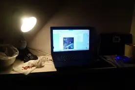 身体时常出现4个表现，别总是漠视，也许是肾衰竭“发声”了图片