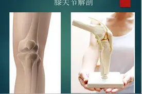 （干货收藏）膝盖疼，这几点医学常识要学起来（图文并茂）图片