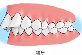 牙齿对颜值的影响有多大？图片