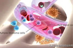 多发性骨髓瘤CART细胞疗法Abecma(ide-cel)在日获批图片