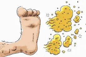 它们是脚气天然的“克星”？常用4样种草泡脚，或有助抑菌止痒图片