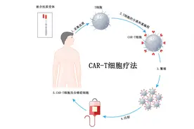 复发/难治性滤泡型淋巴瘤CAR-T细胞疗法Kymriah获FDA加速批准图片
