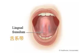 快看看孩子的舌头，有这种情况千万留意！——太原语言康复训练图片