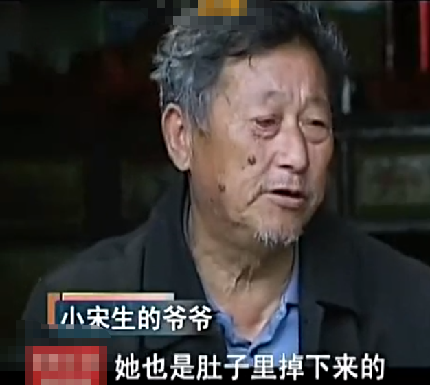 弥漫性表皮松懈角化症