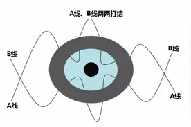 派特灵派特生物科普｜冷刀宫颈锥切术操作步骤和注意事项图片