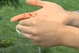 07年云南小伙和3米长黄金蟒同吃同睡形影不离，4年后蟒蛇突然逞凶图片