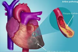 冠心病常用这10类药，多角度改善心肌缺血，减少心绞痛，保护心脏图片