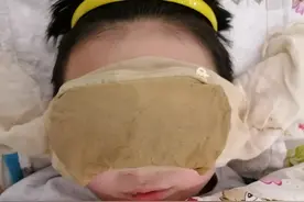 中药外敷，治好了儿子的假性近视图片