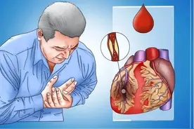为什么心脑血管病致死率高？坦白说，这4个因素常被忽视图片