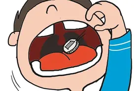 五岁男孩误吞硬币，无痛胃镜安全快速取出图片