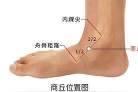 踝关节扭伤针灸治疗图片