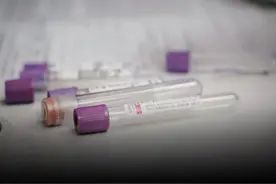 13岁女孩抽出2000毫升“牛奶血”！医生：她这个习惯很多人都有！图片