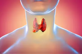 白萝卜是结节的“加速器”？消化科医生：不想结节癌变，少吃4物图片
