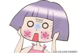 脸颊红是什么原因造成的怎么解决图片