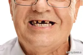 掉牙的原因是什么？不及时补牙危害大！图片