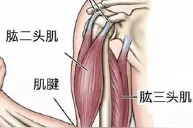 肱二头肌长头肌腱损伤的病因、诊断及康复图片