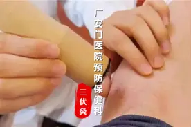 冬病夏治 | 预防保健科三伏灸图片